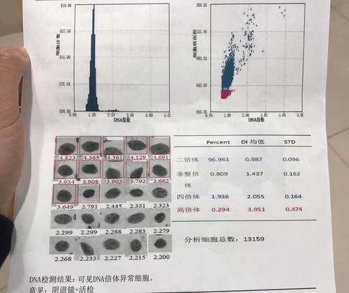 hpv阳性,tct有非典型鳞状细胞,,活检报告出来了 