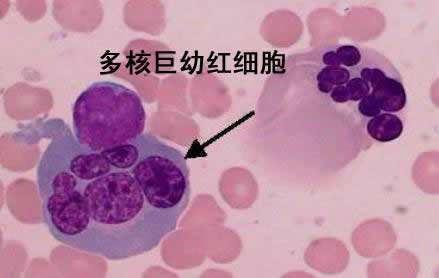 大红细胞1.80,大红细胞多少正常