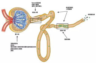 决定副蛋白肾脏沉积部位 4 大因素