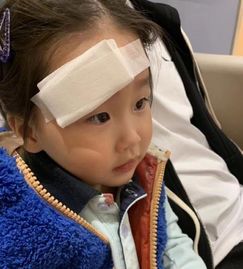 赵文卓三岁女儿脸部受伤缝七针,含泪不哭妈妈夸宝贝坚强