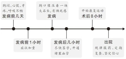 心梗发作有条 时间轨迹 从1个月前到1小时前各有表现