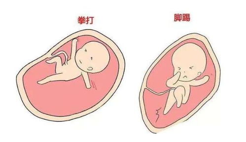原创胎儿的性格与胎动有关，你家宝宝的胎动会是下面哪一种呢？