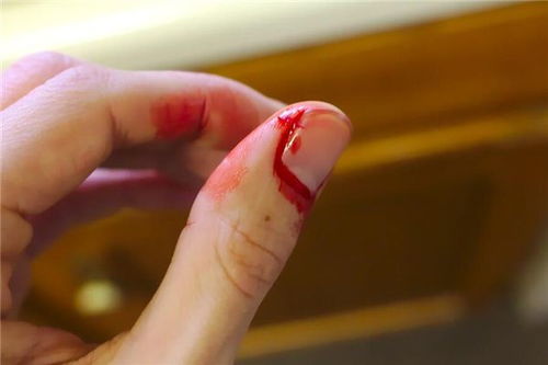 手指划伤见血的预兆