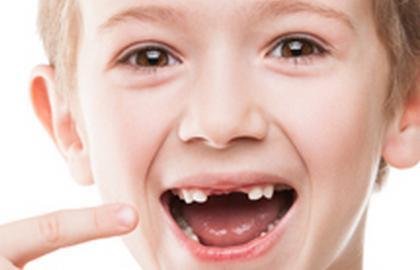 宝宝的牙齿发育,家长不可忽视