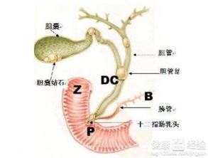 关于胆管癌后期引流的问题