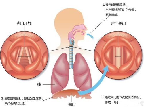 狐大医 重要场合突然打嗝不止 教你几招快速止嗝