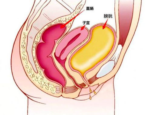 子宫肌瘤需要做手术吗(多发型子宫肌瘤需要做手术吗)