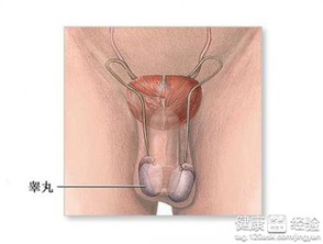 睾丸鞘膜积液？左侧睾丸鞘膜腔积液