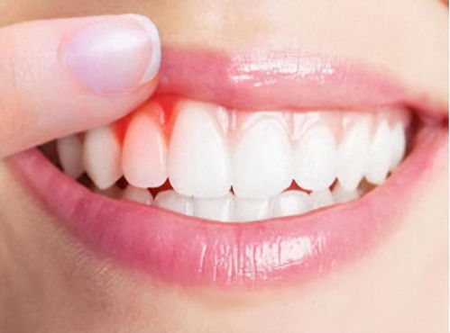 掉牙和寿命有关 六十岁的人,牙齿剩多少颗才正常 看看你达标吗