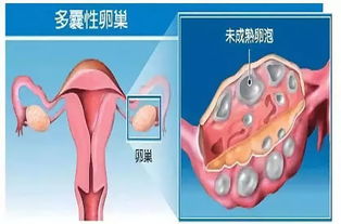 经期量多是好事 关于卵巢的八大谣言,今天一次辟清