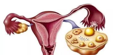 怎么养护卵巢,怎么保养卵巢最好