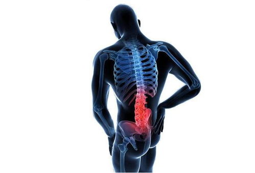 尾骨痛是因为坐时间长 可能比你想象的更严重 医生教你3招缓解