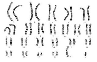 染色体异常不孕不育,染色体异常导致不孕不育：原因、诊断与治疗  第2张