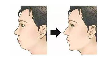 38岁女人面部衰老程度 40岁女人脸型衰老症状