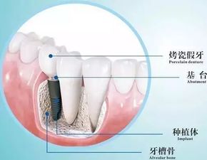 难以置信什么样这么贵,一口牙竟然需要56.83万