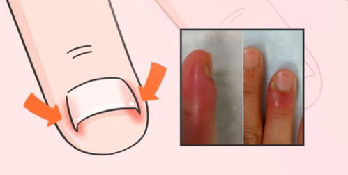 关于指甲的一些冷知识,指甲剪太短危害有多大