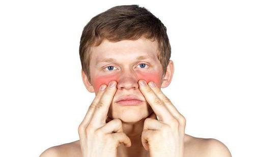 过敏性鼻炎有什么症状表现(过敏性鼻炎的典型症状有哪些)