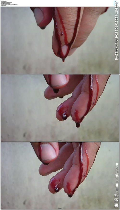 手指头流血的照片真实 搜狗图片搜索