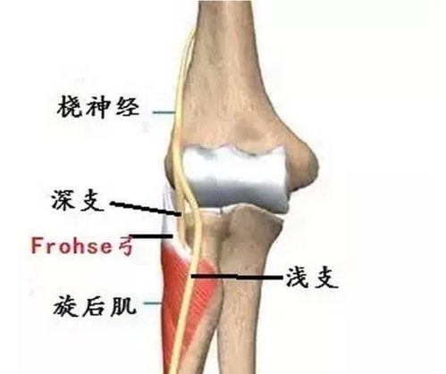 桡神经与相关卡压部位