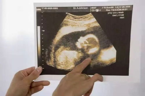 原创怀孕期间，孕妈能避开这4个“异常”，恭喜你，胎儿将会足月出生