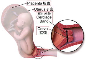 姑娘,小心这个因素 它会让你生孩子很困难