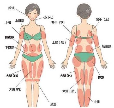 全身吸脂20斤要多少钱 是一次性抽完还是分几次完成