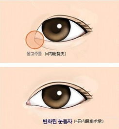 眼睛大的单眼皮适合开内眼角吗, 眼睛大的单眼皮适合开内眼角吗？<p>标签：单眼皮开内眼角 眼睛大开内眼角</p></p><p></p><