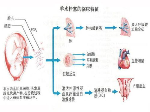 害怕羊水栓塞不敢生孩子怎么办