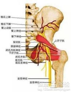 治疗坐骨神经痛的偏方