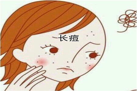 青春期女孩长痘痘怎么办