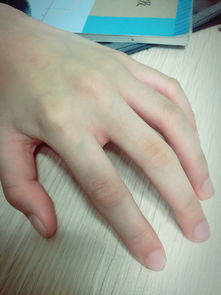 手指半月白消失了是什么原因