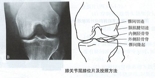 骨科X线检查看这一篇就够了