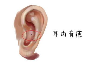 耳朵痣相详解 你知道耳朵上长痣都代表什么吗