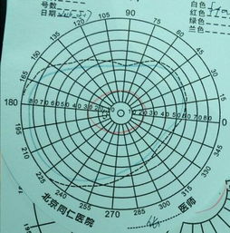 视野的意思视野是什么意思