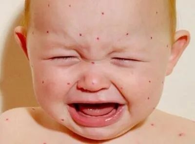 俏管家家政,又到流感高发季 警惕这6种常见疾病,及早预防,宝宝少生病 小孩子 