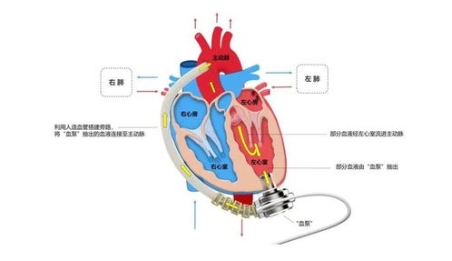 人工心脏起搏系统主要包括哪些部分？