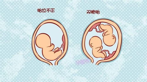 原创备孕前，有这4种状况的女性最好做孕前检查，不要不当回事！
