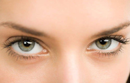 肿泡眼适合做那种双眼皮 教你对症下药解决肿泡眼