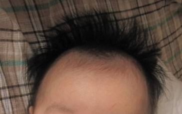 宝宝头发竖着长代表发育好 错 遇上这几种情况可能身体亮了红灯