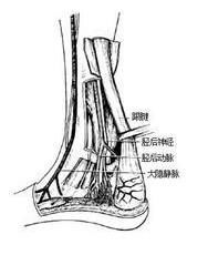 什么是跟腱,跟腱伤了怎么调理？-第1张图片