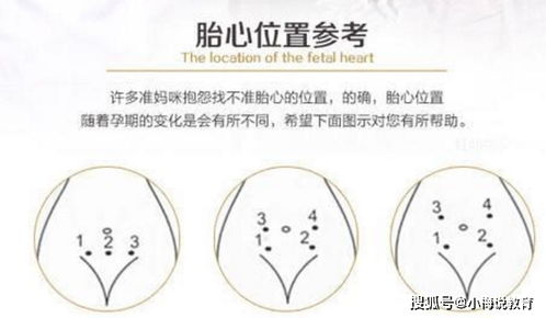 原创脐带绕颈时，胎儿可能会发出3个“信号”，现在知道还不算晚