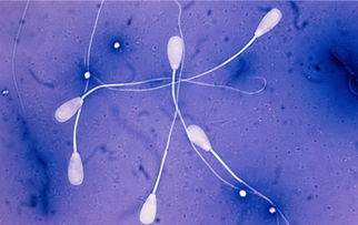 男人的精子成活率多少正常,为何精子成活率低？这些原因或可以避免，提高精子成活率