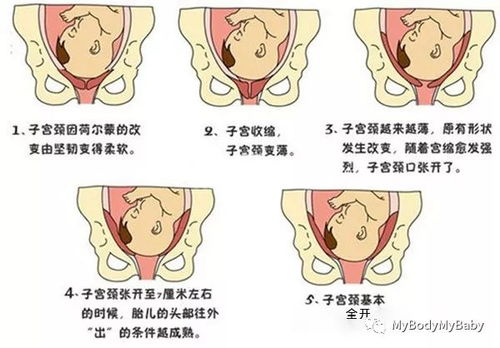 子宫女性生孩子图片