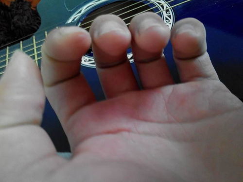 我的手指是不是不适合弹吉他啊,指头肉太厚了,按三弦肉碰到二弦 还是我的吉他也太垃圾了,弦距离指板也 