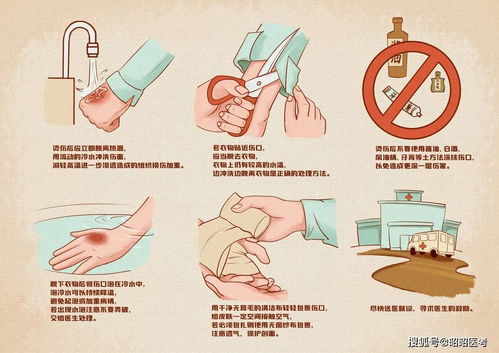 烫伤怎么办 请收好这份烫伤紧急处理指南