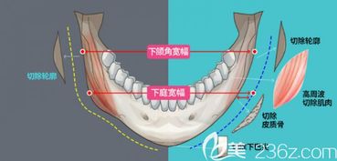 柳超 个人主页 广州广大整形 美佳网 