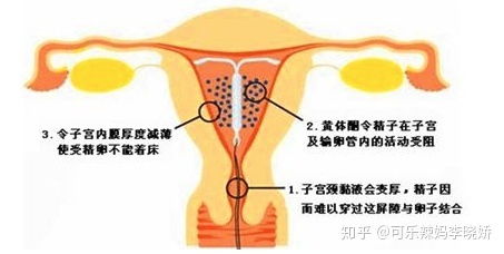 可乐辣妈李晓娇 停用避孕药或避孕环后多久能受孕 