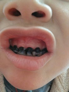 九岁小孩换几颗大牙(9岁孩子换牙几颗牙)