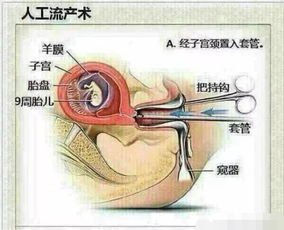 人流对身体的危害大吗 说出来你都不一定会信,涨知识了 