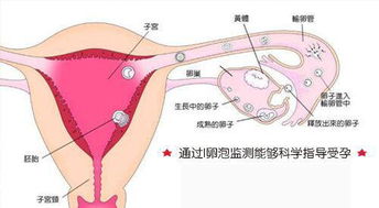 多囊没治疗自己怀孕了，会有什么影响吗